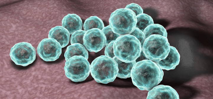 GeneProof Chlamydia pneumoniae PCR Kiti - (IVDR)