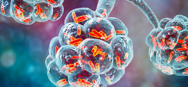 GeneProof Mycoplasma pneumoniae PCR Kiti