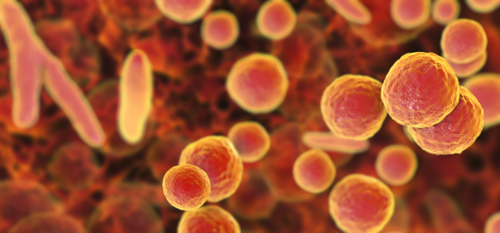 GeneProof MH/UU/UP Multipleks PCR Kiti - (IVDR)